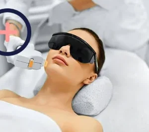 IPL Skin Rejuvenation, Rosacea & Acne